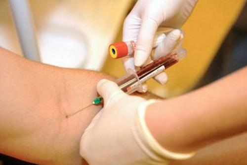 HCG检查需要空腹吗,血HCG检查最佳时间 乐哈