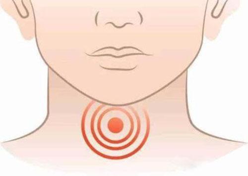 咽炎的危害 不能忽视咽喉炎的危害