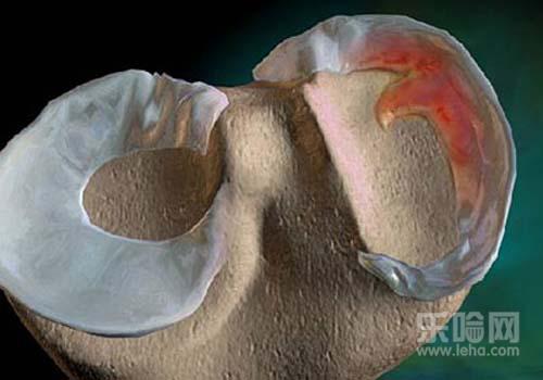 滑膜炎轻微症状有哪些,滑膜炎初期症状有哪些