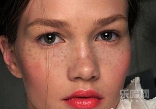 妊娠斑多久会自然消失,妊娠斑多长时间能消失