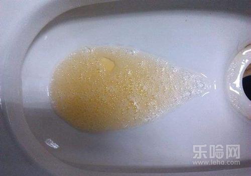 尿酸高尿液是啥颜色,尿酸高撒尿有什么症状-乐