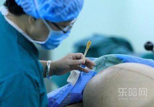 第二胎剖腹产会比第一胎痛吗,生二胎剖腹产会