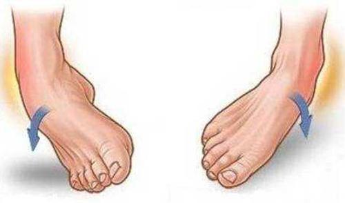 崴脚了怎么快速恢复 五个小技巧你要知道