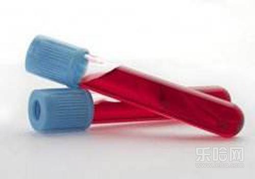 取环前注意事项有哪些,取环前要做哪些检查-乐