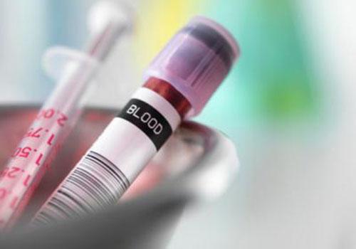 抽血能查出艾滋病吗,抽血可以检查出艾滋病吗