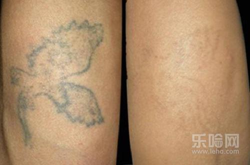 纹身能彻底洗掉吗,洗纹身多久可以洗掉-乐哈健