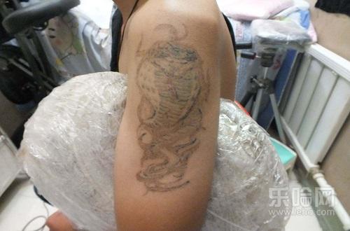 纹身能彻底洗掉吗,洗纹身多久可以洗掉-乐哈健