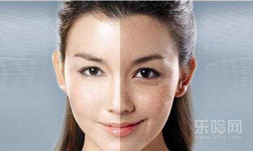 激光祛斑可以吃酱油吗,激光祛斑吃酱油会怎样