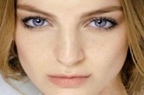 激光祛斑反黑多久消失,激光祛斑反黑期持续多