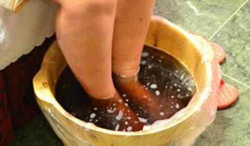 静脉曲张患者别用热水泡脚