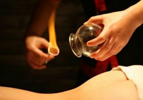 拔火罐有什么好处