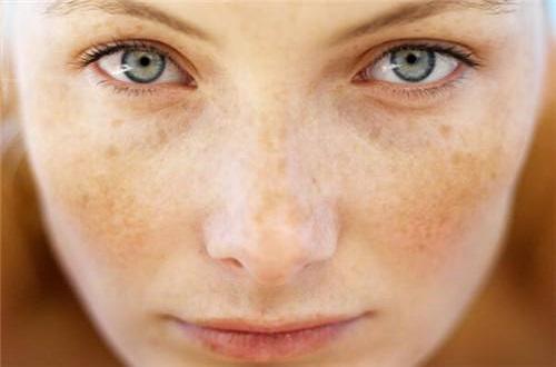 脸上长斑吃维生素e和c能去掉吗,脸上长斑吃维