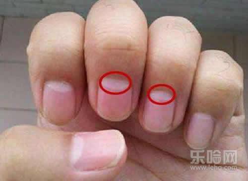 手指甲上没有月牙吃什么补,指甲没有月牙吃什