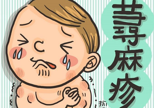 荨麻疹涂什么止痒效果好 涂这6种止痒见效快!