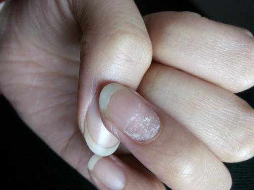 肝不好有什么症状 肝不好眼睛和手有这些症状