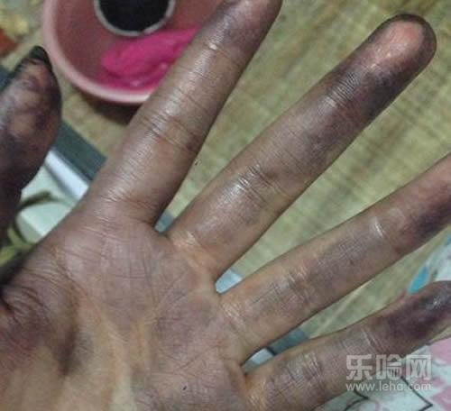 染发膏弄手上怎么洗掉,染发膏染到手上怎么办