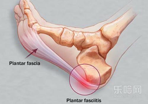 脚后跟底部疼是什么原因,脚底后跟痛是什么原