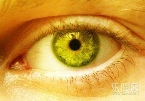 眼白发黄是怎么回事怎样快速变白,眼白发黄怎