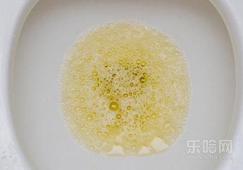 尿液发黄有异味是怎么回事