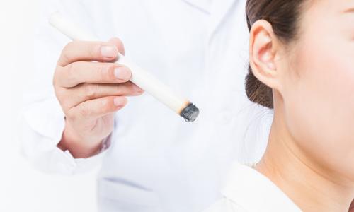 艾炙肚脐后的排湿反应