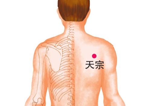 乳腺增生拔罐方法图 乳腺增生拔罐有效果吗