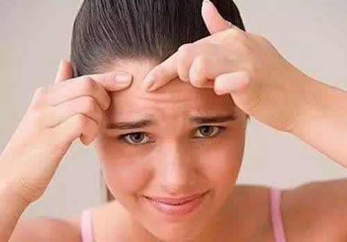 发际线长痘痘是什么原因,发际线长痘痘的原因