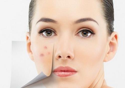 脸红起小疙瘩怎么回事,脸红起疙瘩怎么回事,脸