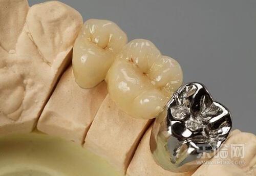 假牙多久换一次,假牙可以用多久-乐哈健康网