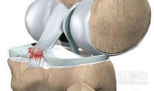 半月板损伤的最好治疗,半月板损伤怎么治好-乐