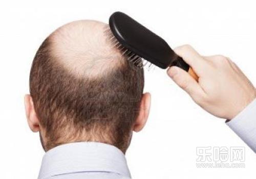 掉发严重是什么原因,掉发掉的很多怎么回事-乐