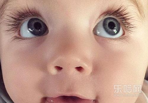 甲亢突眼能恢复吗,甲亢突眼可以恢复吗,甲亢突