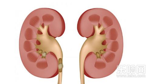 肾积水严重吗能治好吗,肾积水严重吗怎么治疗
