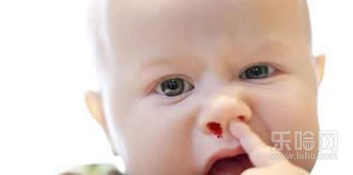 宝宝鼻子出血是怎么回事,宝宝鼻子出血是不是