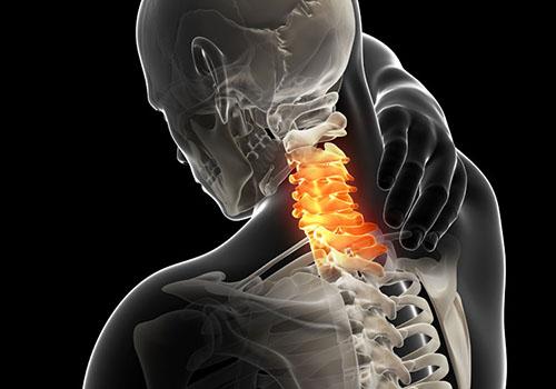 颈椎病不用枕头