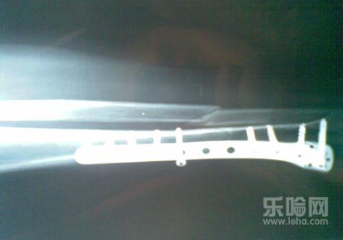 骨折愈合时间,骨折多久能好-乐哈健康网