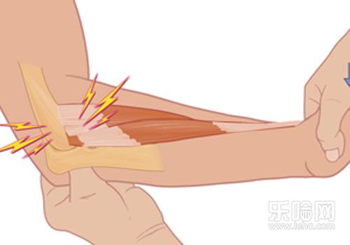 骨折多久能消肿,骨折消肿需要多久,骨折多长时