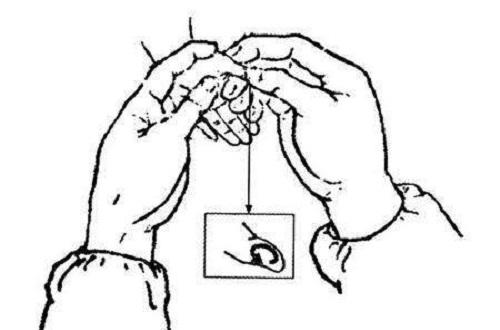 小儿肠绞痛诊断要点