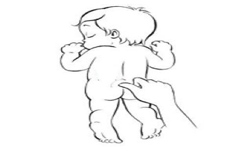 小儿寒湿型拉肚子推拿手法