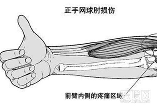 网球肘最佳治疗方法,网球肘治最好-乐哈健西式风帆船图片
