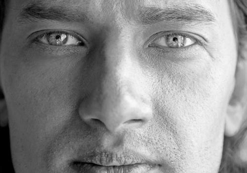 前列腺增生伴钙化灶什么意思 前列腺钙化症状