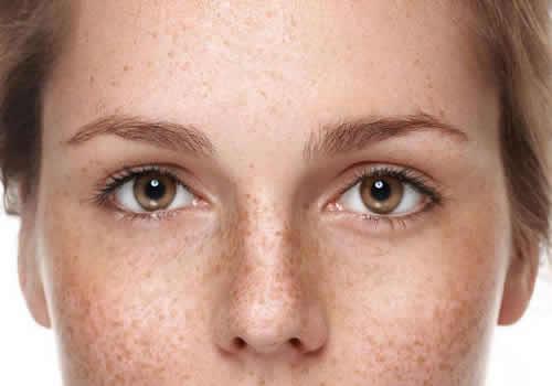 离霜会长斑吗 错误使用隔离霜小心变麻子脸!