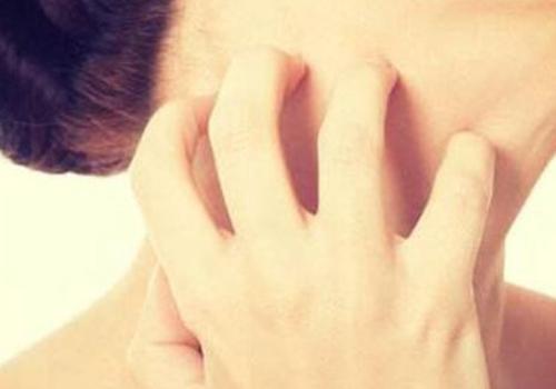 皮肤瘙痒流黄水怎么办