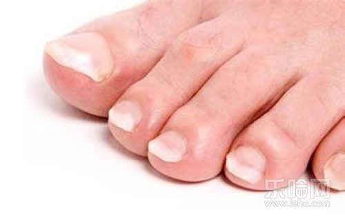 脚趾甲空了是什么原因,脚趾甲变空是怎么回事