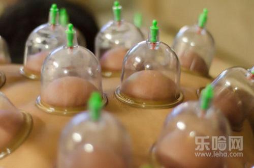 拔罐放血有什么好处,拔罐放血的好处和坏处-乐