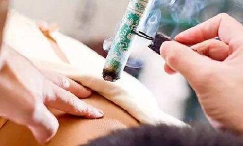 艾灸对鼻炎有效果吗,鼻炎艾灸哪个部位图解-乐