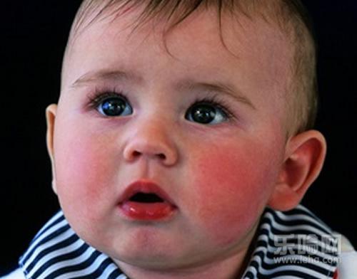 宝宝冬天脸红怎么回事,宝宝冬天脸红的原因-乐