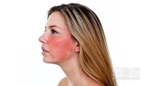 脸红是什么原因造成的,容易脸红是什么原因,喜