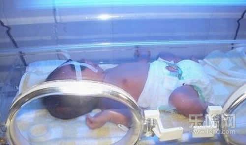 黄疸高对婴儿有什么影响,新生儿黄疸高有什么