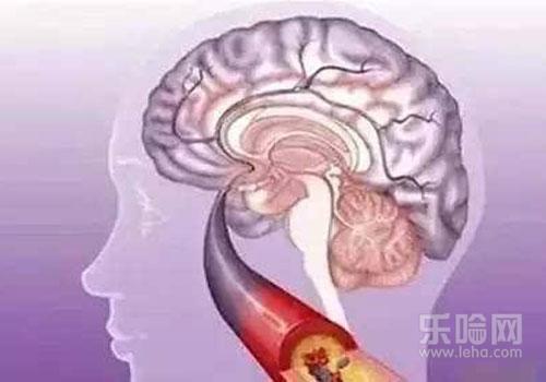 脑梗后期的恢复有哪些好的建议,脑梗塞后期的