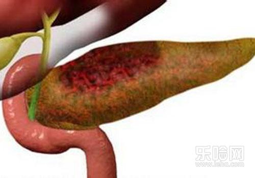 急性胰腺炎为什么低钙,急性胰腺炎低钙血症-乐哈健康网